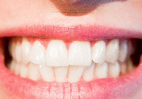 Βρουξισμός - Οδοντιατρική Κλινική Πέτρος Θεοδωράκης